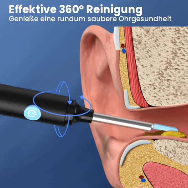 Nettoyeur d'oreille à caméra